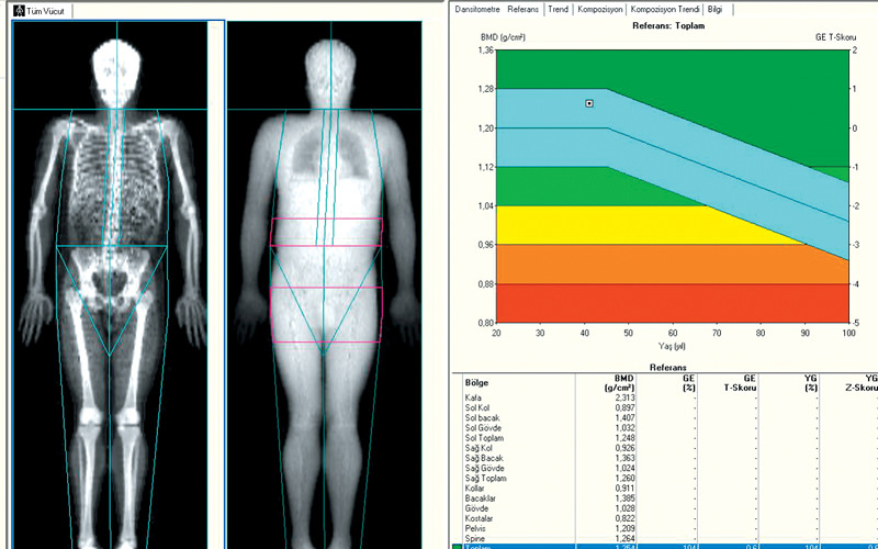 Kemik Yoğunluğu Ölçümü