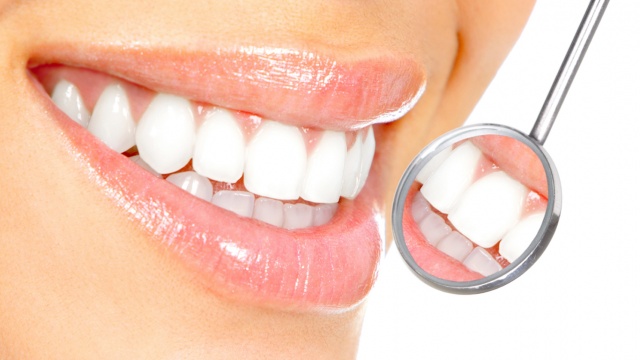 Diş Beyazlatma (Dental Bleaching)