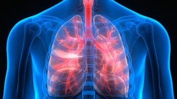 Akciğer Embolisi Görülme Olasılığı Kimlerde Fazla?