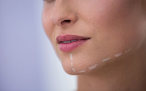 Masseter Botox (Çene Botoksu) Nedir?