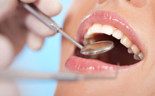 Periodontoloji