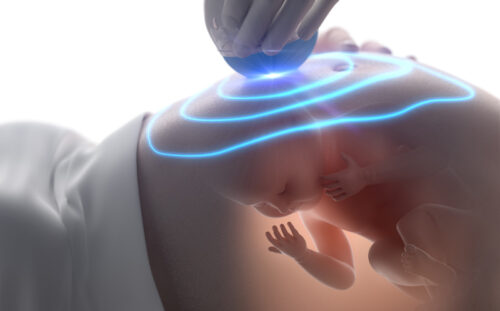 Genetik Sonografi