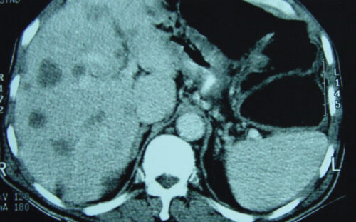Multislice Computed Tomography 128 Slice