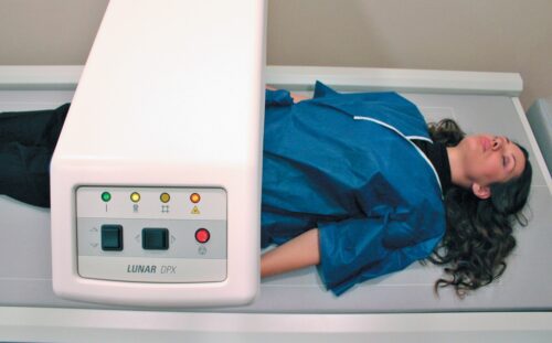 Bone Mineral Densitotometry