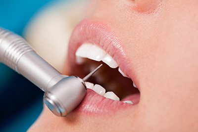 Endodonti (Kanal Tedavisi)