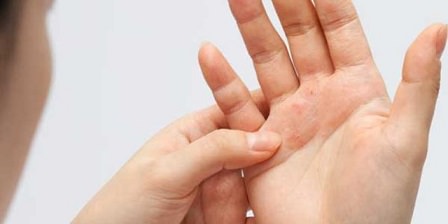 Skin Lesions