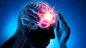 Epilepsi Nedir? Nedenleri Nelerdir?