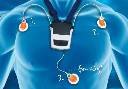 Rhythm Holter