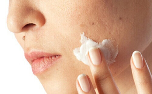 Dermatolojik Hastalıklar