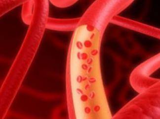 Myocardial Perfusion Scintigraphy (MPS)