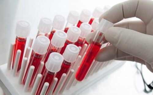 Serology