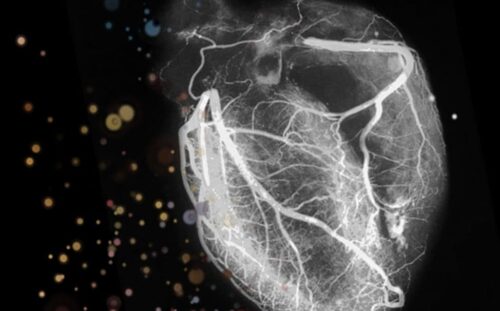 Cardiac PET / CT