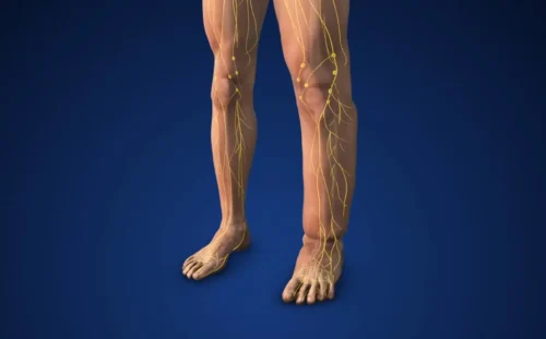 Lenfödem ve Lipödem