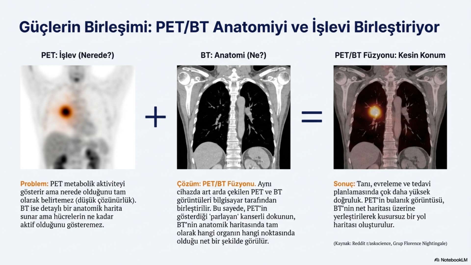 Pet Ct Nasıl bir çekimdir
